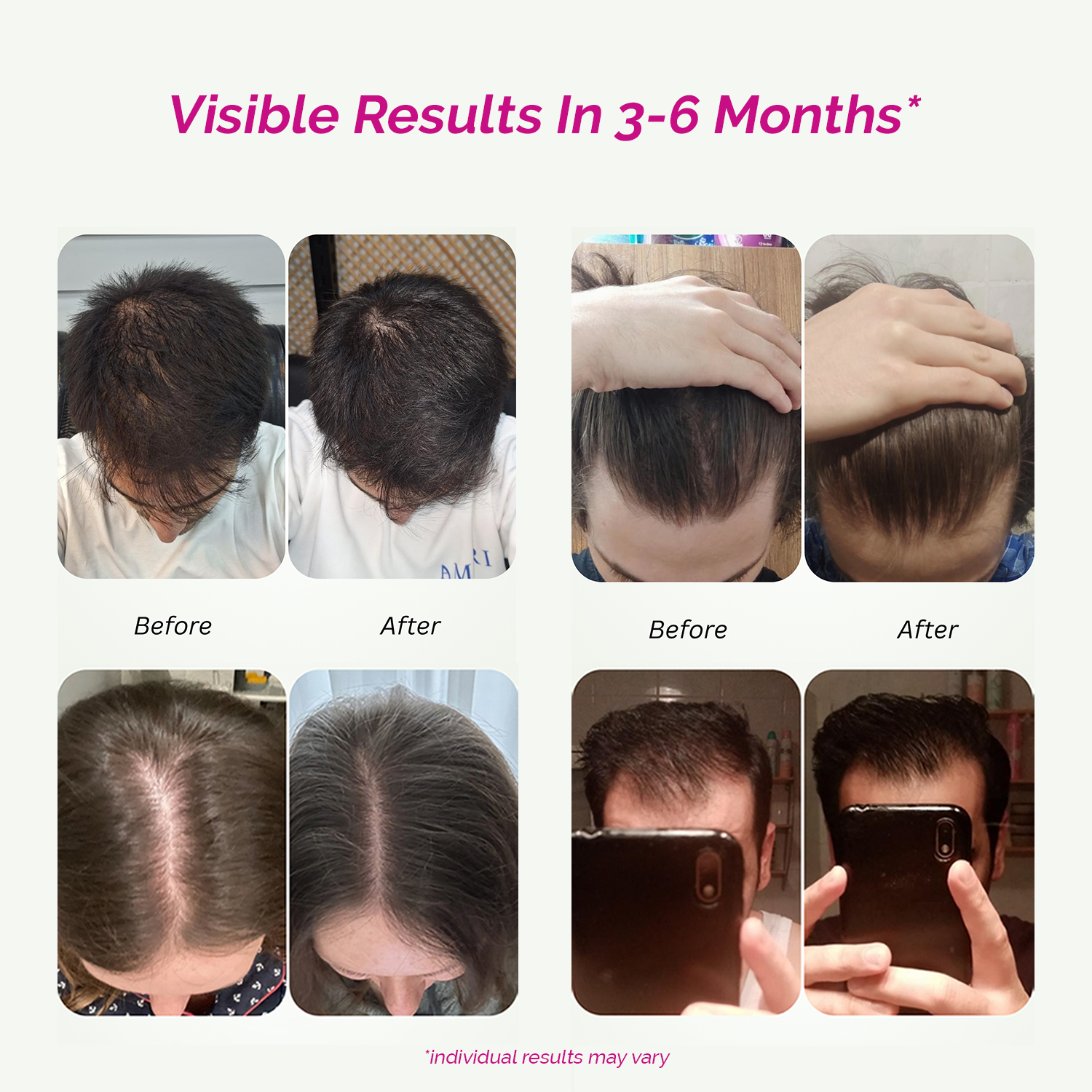 Hair Growth + Skin Pro For Men & Women