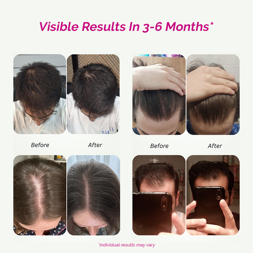 Hair Growth + Skin Pro For Men & Women